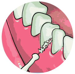 Spagnolo-Dental-Prevencion-09